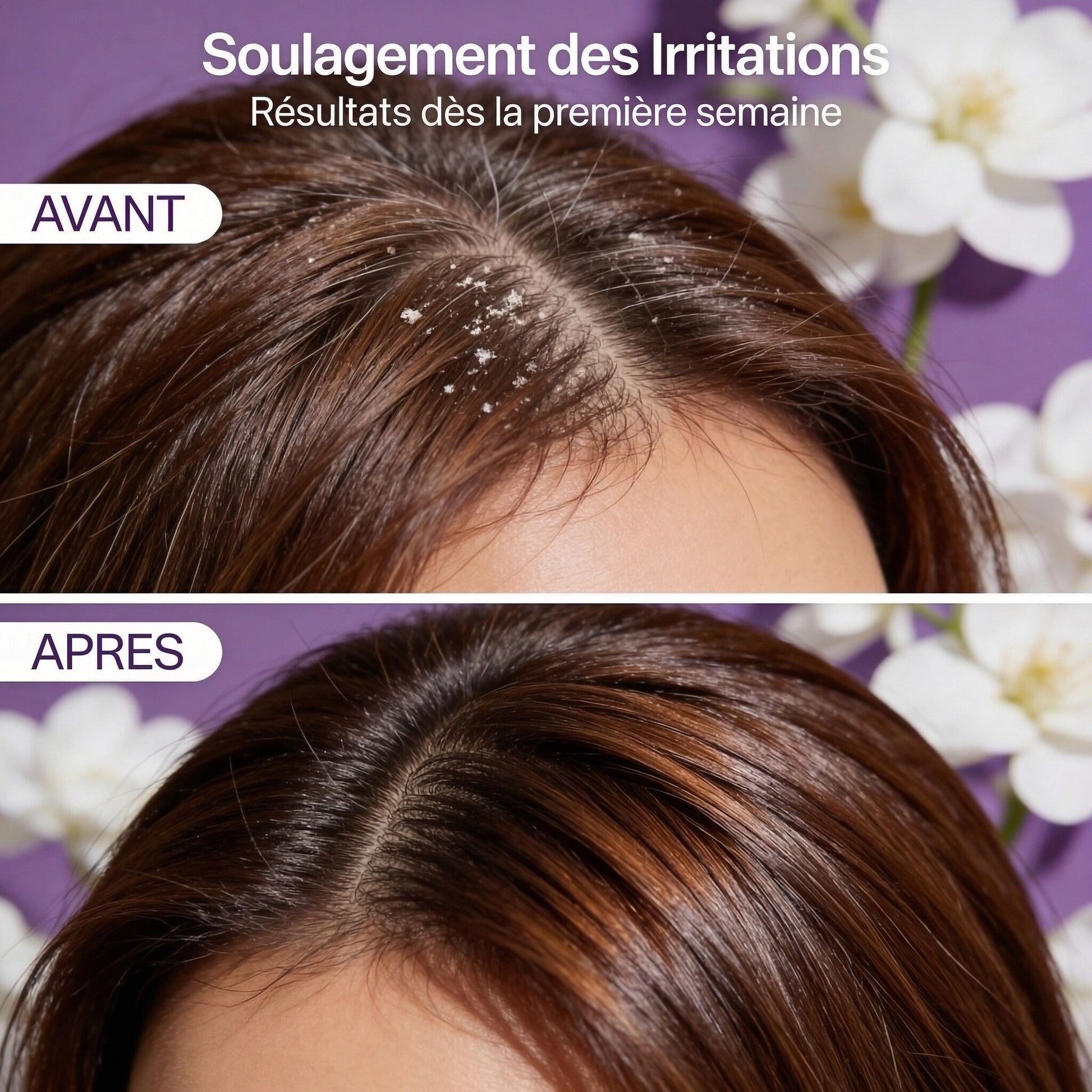 Shampoing Apaisant Cuir Chevelu Sensible - JODHUR