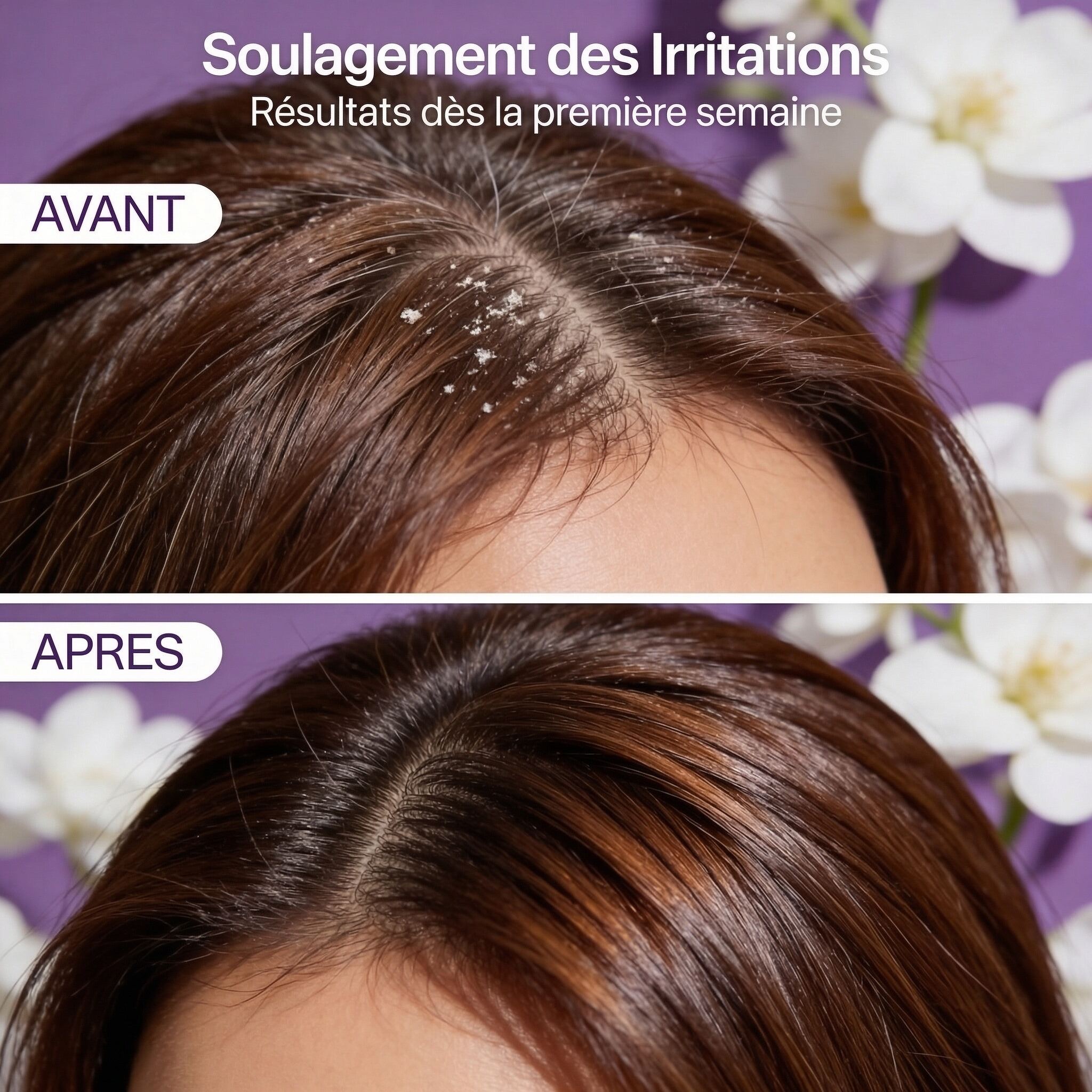 Shampoing Apaisant Cuir Chevelu Sensible - JODHUR