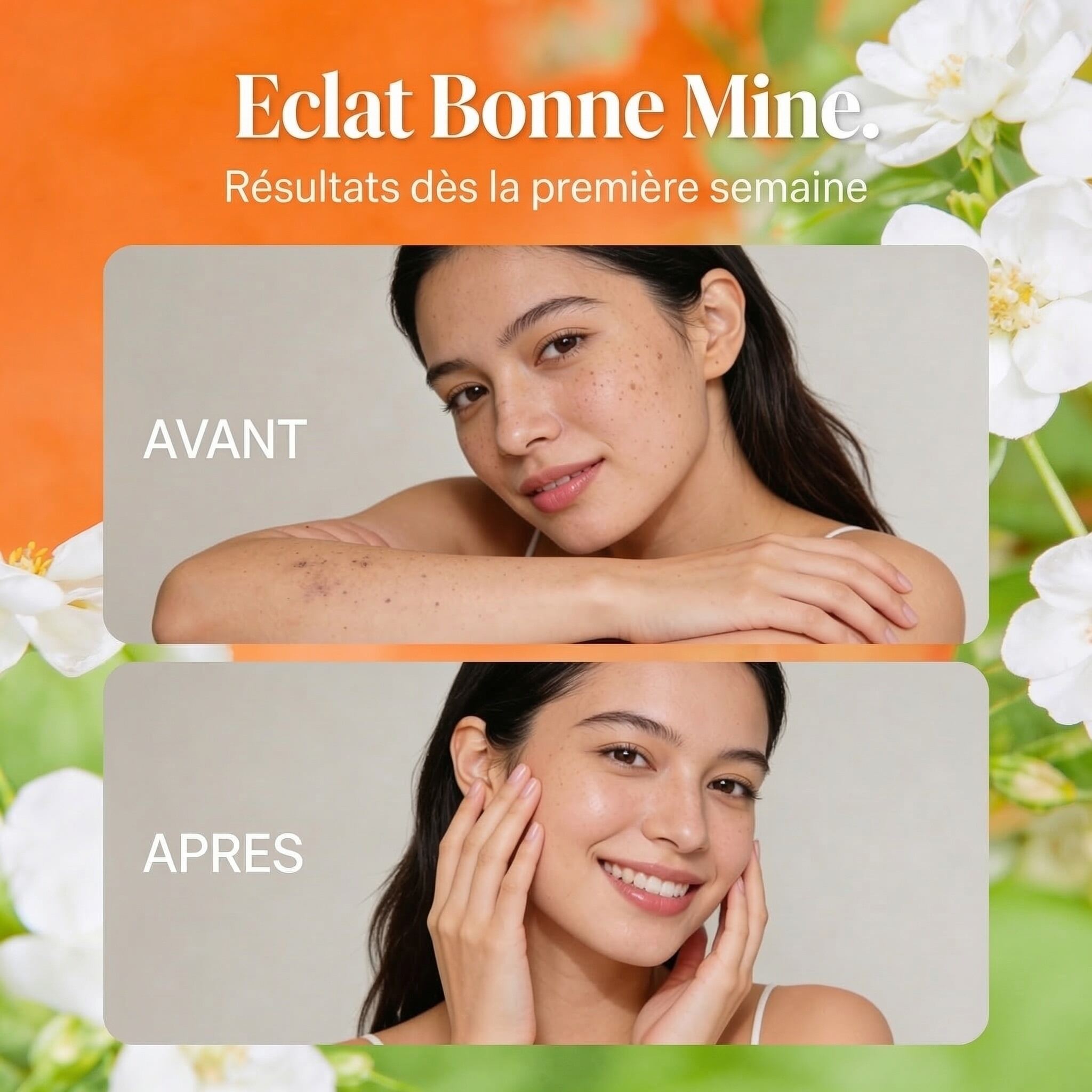Before and after photos showing skin improvement using Huile Noyau d'Abricot BIO – Éclat Bonne Mine product.
