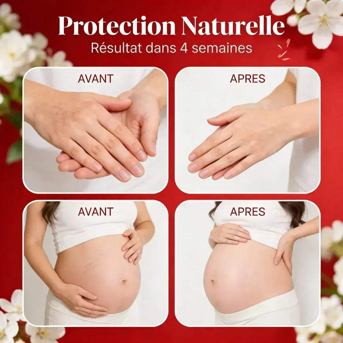 Baume Anti-Vergetures BIO – Prévention & Atténuation - JODHUR