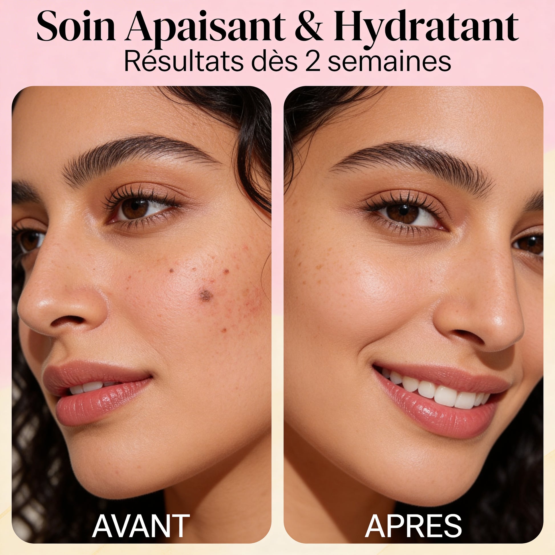 JODHUR Crème de Rose – Soin Apaisant & Hydratant enrichi en moringa pour une peau nourrie, apaisée et éclatante de santé.