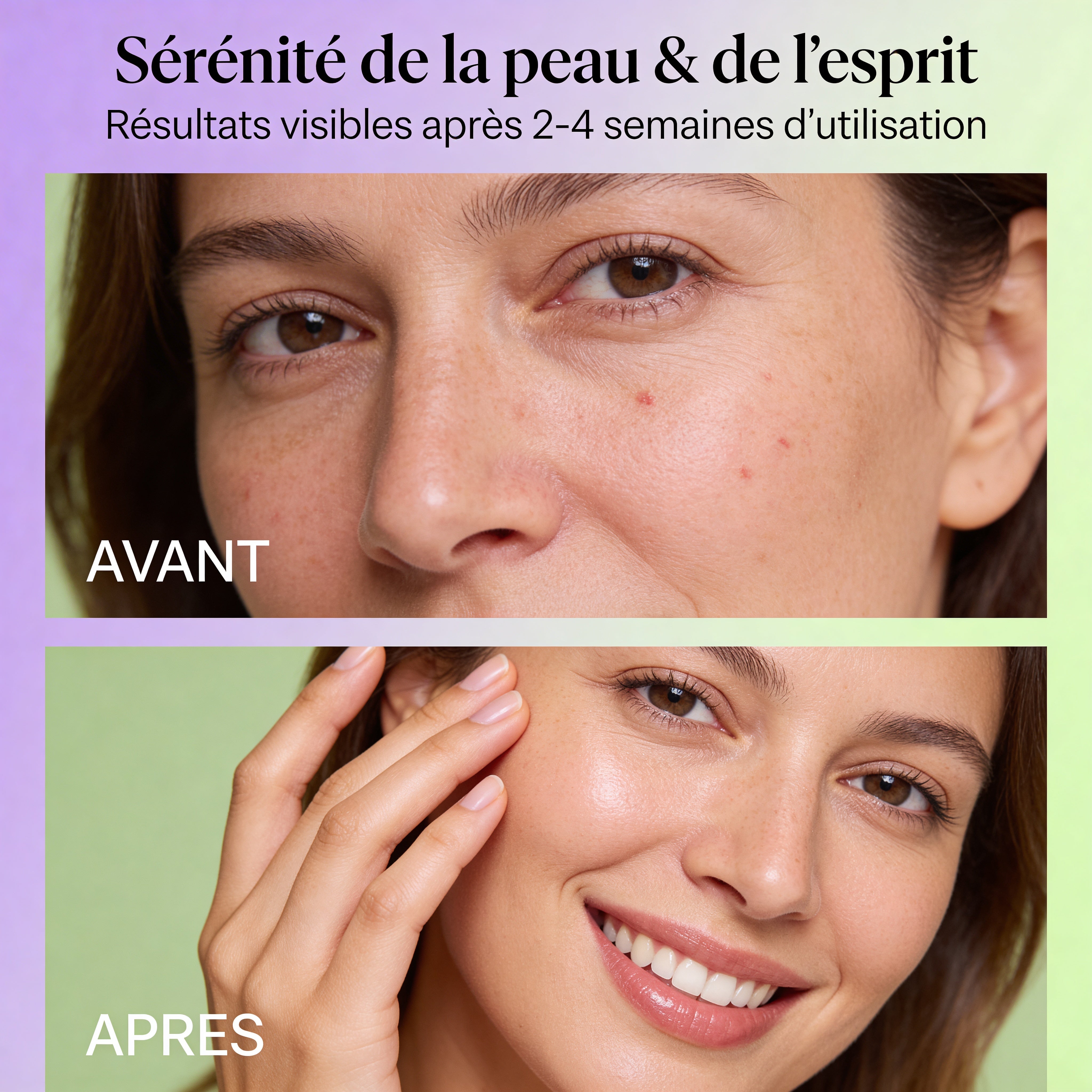 Comparison of skin before and after using Huile Essentielle Lavande Fine BIO | Peau sensible : calme rougeurs & irritations