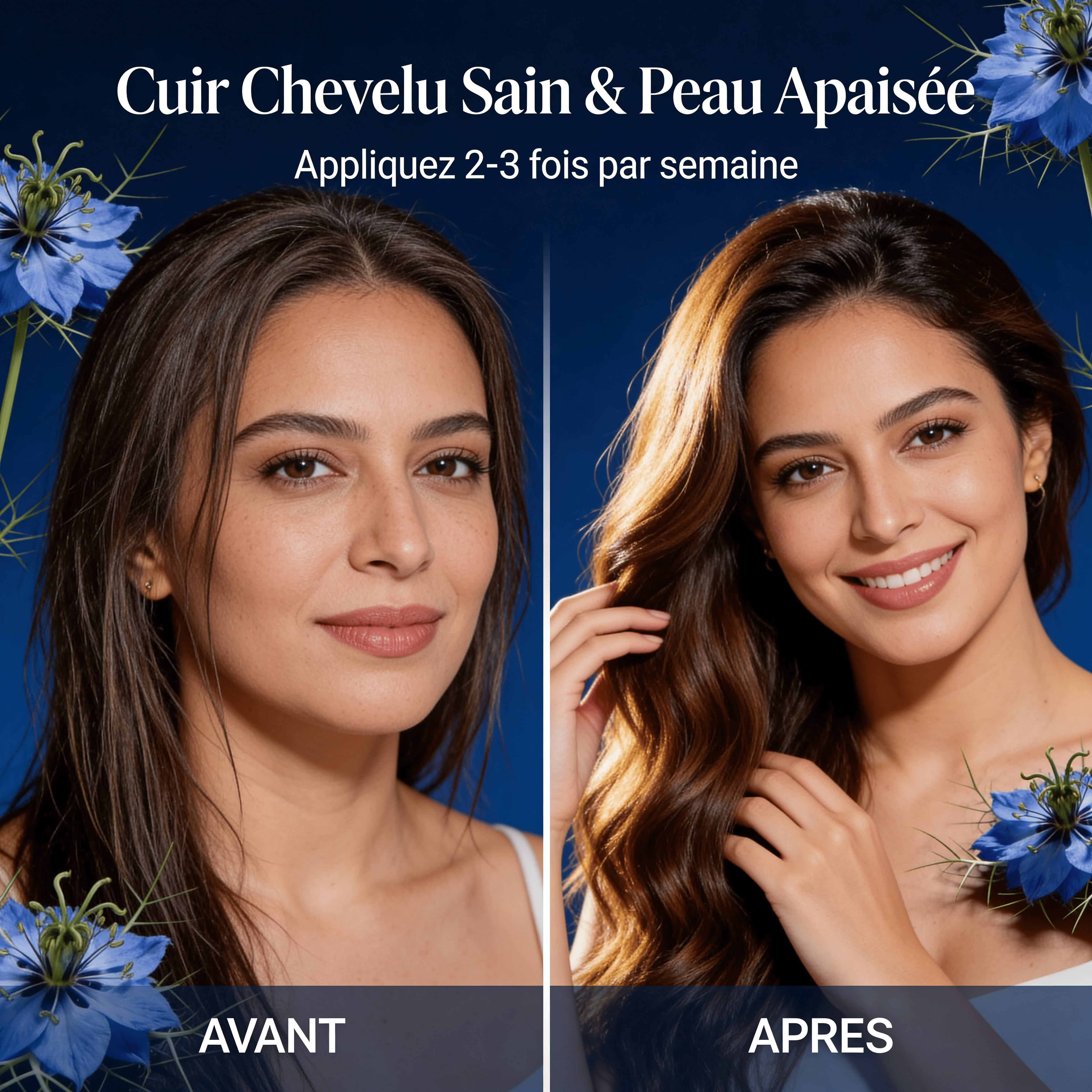 JODHUR Huile de Nigelle Pure- Purifie le Cuir Chevelu & Apaise les Peaux à Problèmes avec infusion de moringa, soin purifiant naturel.